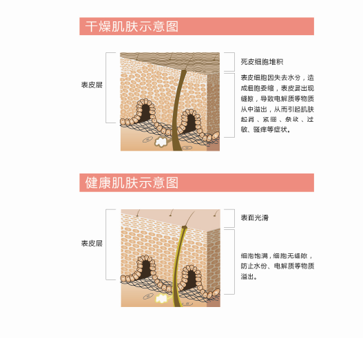 皮肤乾燥 皮肤乾燥
