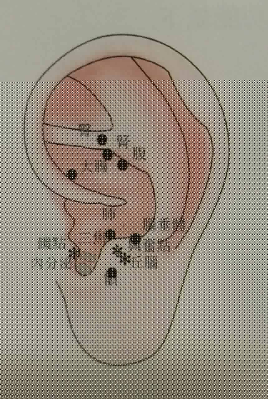 耳穴 耳穴