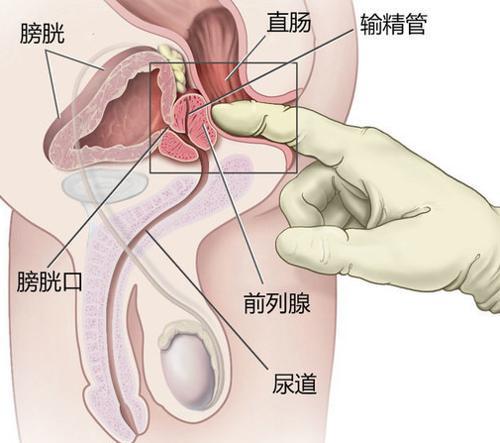 女性前列腺 女性前列腺