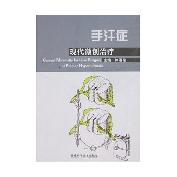 手汗症现代微创治疗