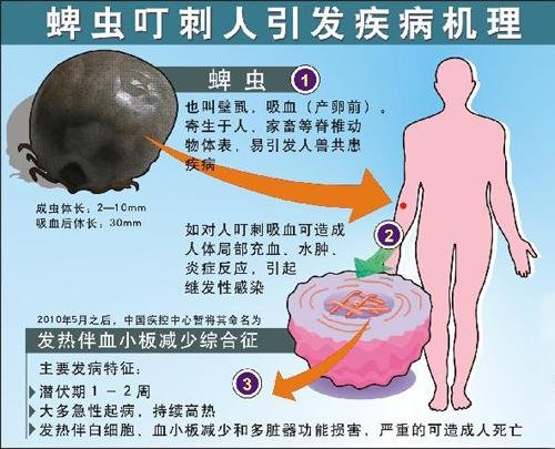叮咬机理 叮咬机理