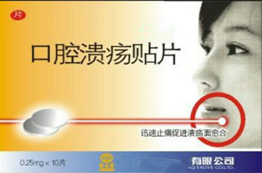 口腔溃疡贴片 口腔溃疡贴片