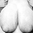 乳房巨大 乳房巨大