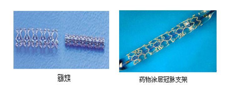 血管支架 血管支架