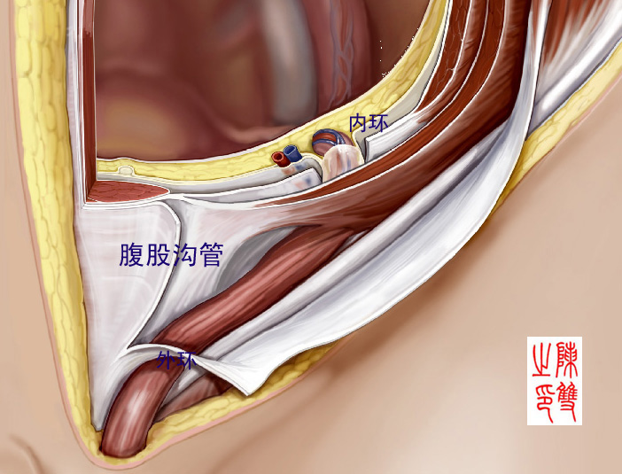 腹股沟三角 腹股沟三角