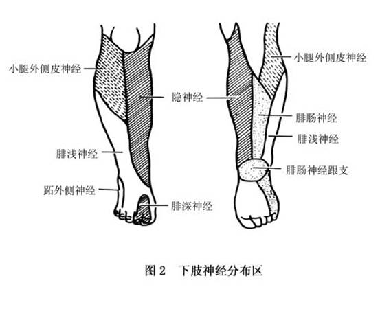 大腿以下或膝以下肌肉瘫痪 大腿以下或膝以下肌肉瘫痪