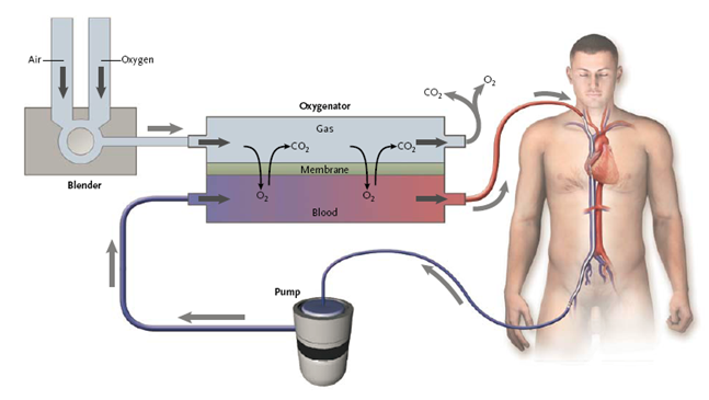 ECMO ECMO