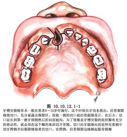 牙槽突 牙槽突