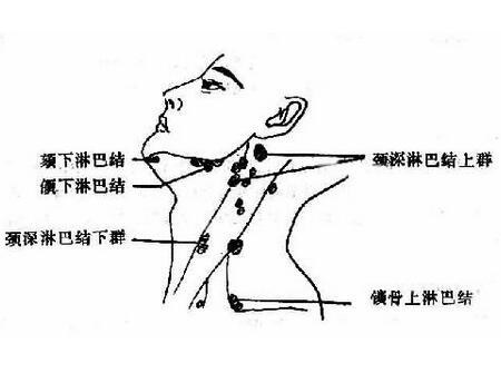淋巴 淋巴