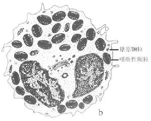 特发性嗜酸性粒细胞增多综合症 特发性嗜酸性粒细胞增多综合症