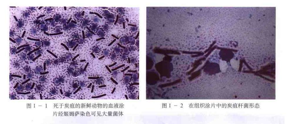 炭疽桿菌 炭疽桿菌