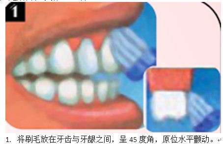 水平颤动法(又称Bass法) 水平颤动法(又称Bass法)