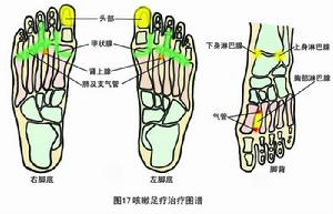 全身淋巴腺 全身淋巴腺