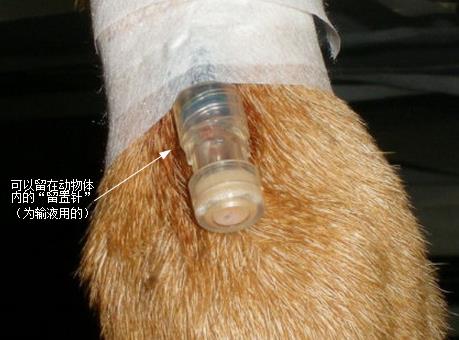 输液用“留置针”