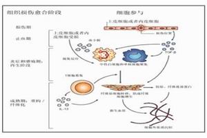 发病机理 发病机理